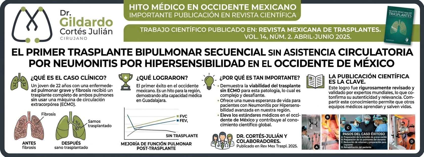 Infográfico del primer trasplante bipulmonar secuencial sin asistencia circulatoria por neumonitis por hipersensibilidad en el occidente de México, caso del Dr. Gildardo Cortés Julián publicado en la Revista Mexicana de Trasplantes 2025