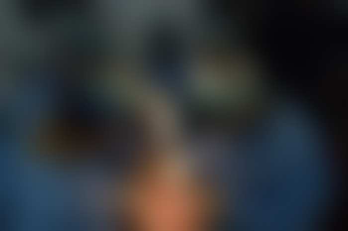 Fotografía clínica difuminada de una cirugía de neumonectomía — clic para revelar